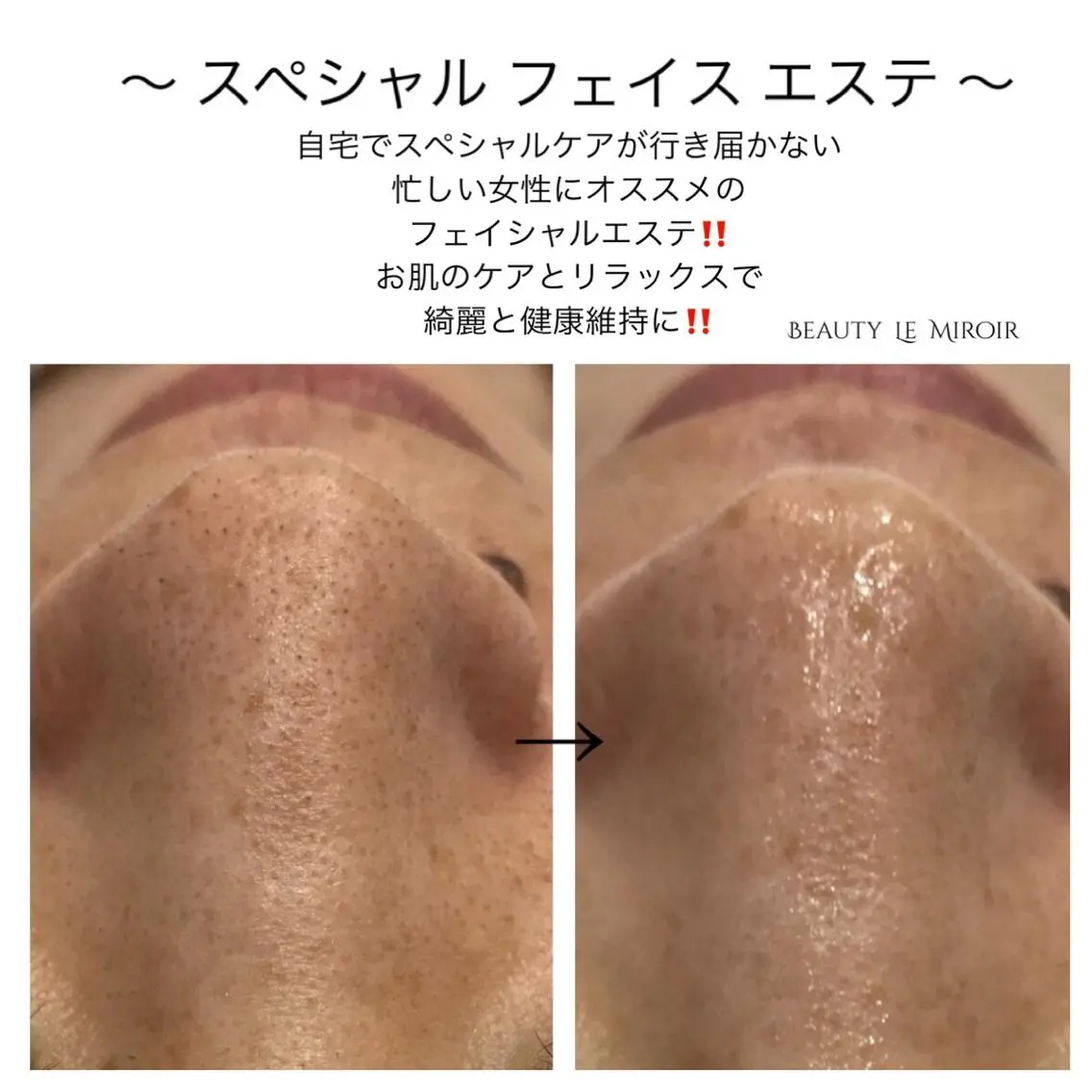 ビューティー ミロワールのエステ・リラクイメージ