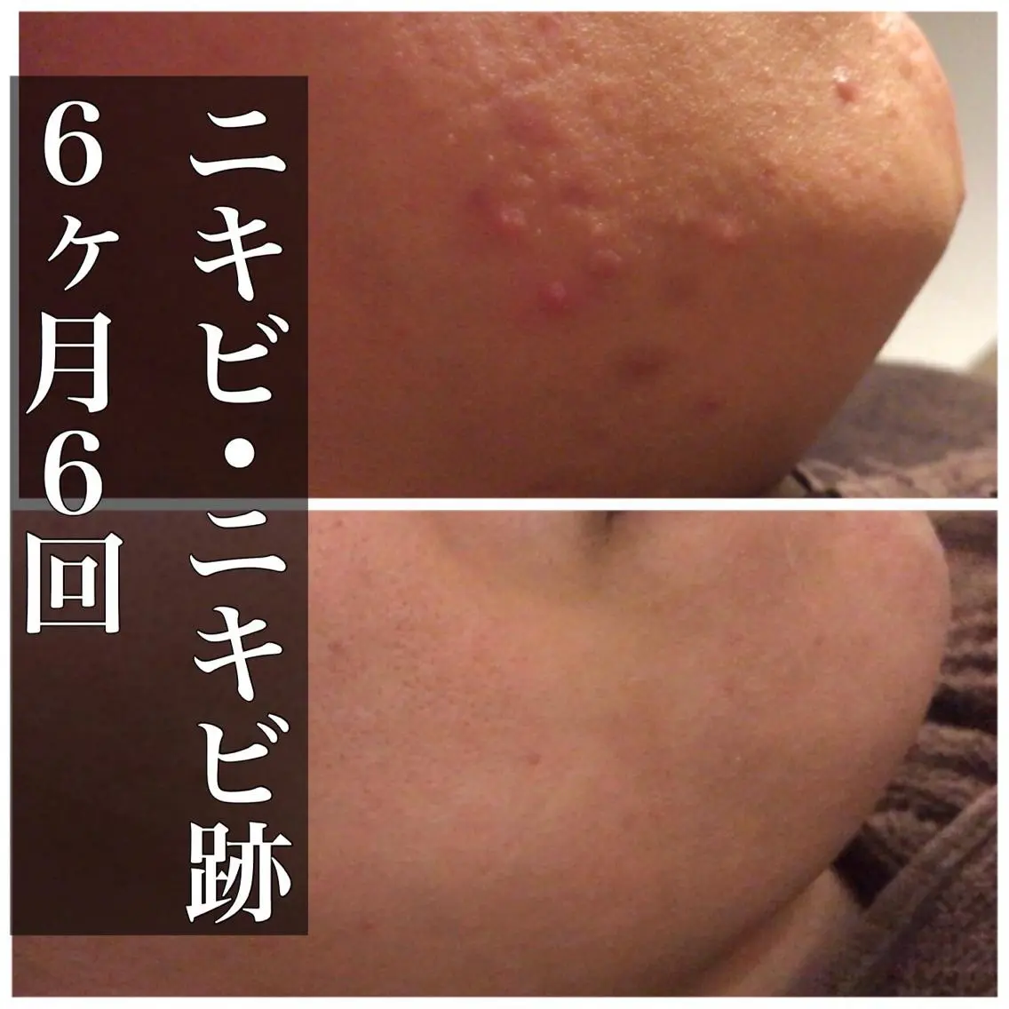 ミディアム カラー パーマ ヘアアレンジ メンズ キッズ ネイル マツエク・マツパ エステ リラク ニキビ・肌質改善専門 ♡人生が変わるサロンのエステ・リラクイメージ
