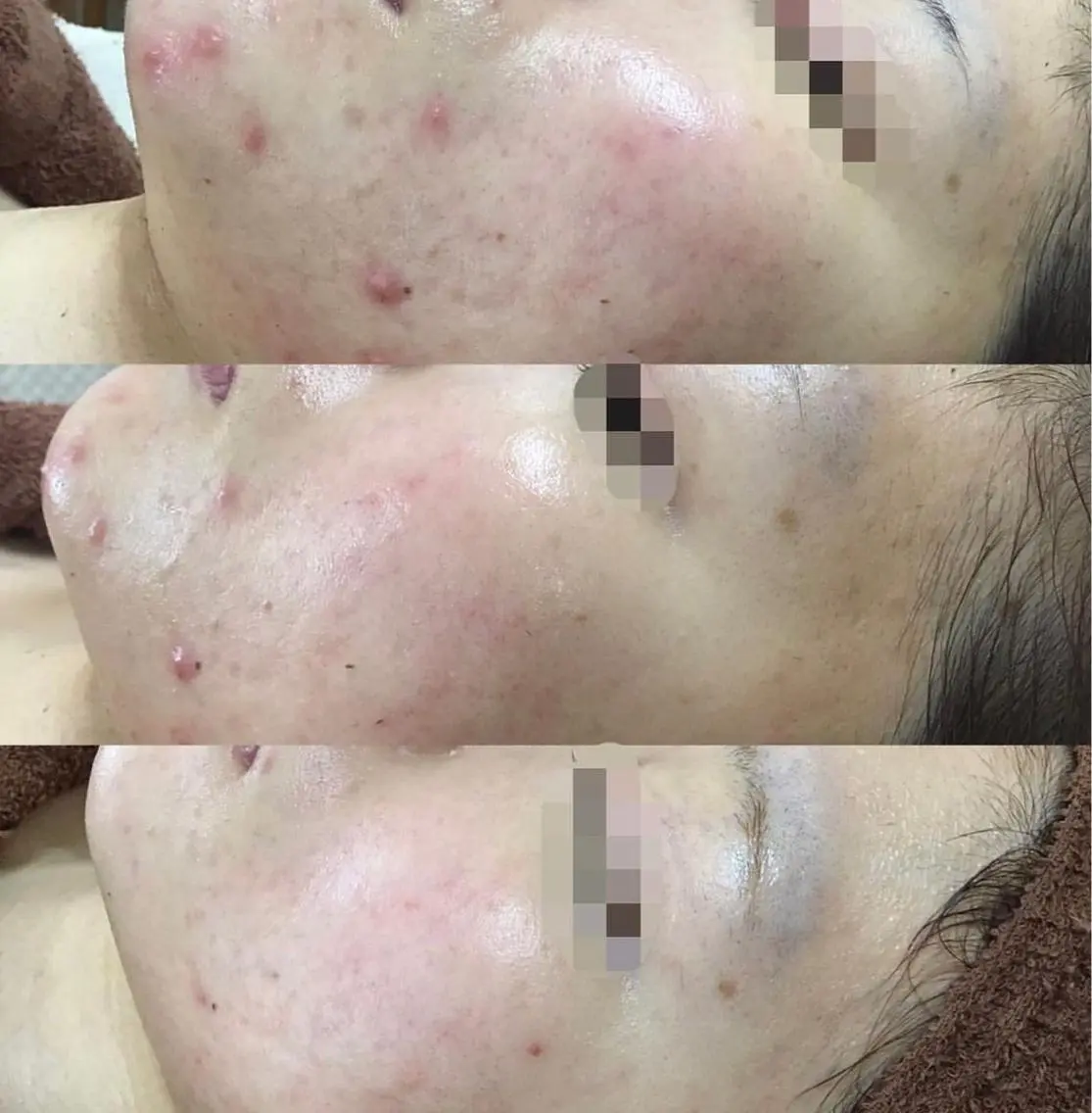 SALON BioBioのエステ・リラクイメージ