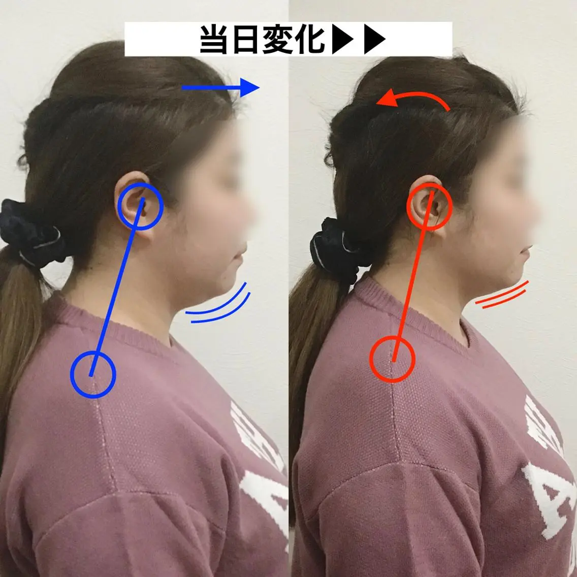顔の歪み矯正専門 宮内翔のエステ・リラクイメージ