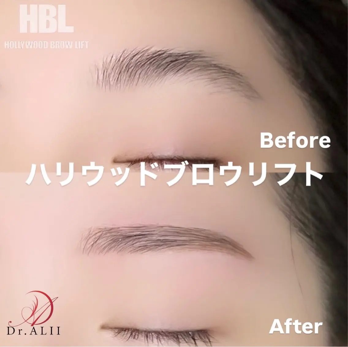 アイブロウ ハリウッドブロウリフト ワックス脱毛 その他(アイブロウ) Dr.ALII 岐南店 鈴村のエステ・リラクイメージ