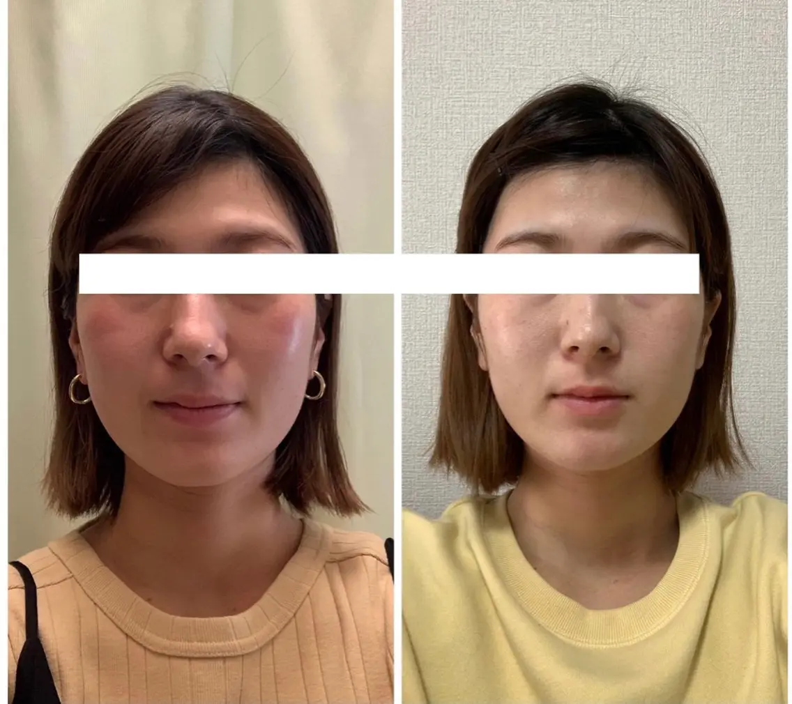 丸顔さんの救世主 高田 くみのエステ・リラクイメージ