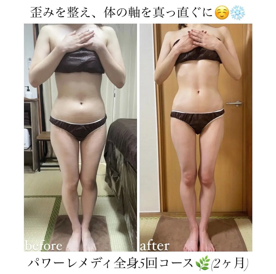 《本気痩せ×疲労改善 》  BILOOPのエステ・リラクイメージ
