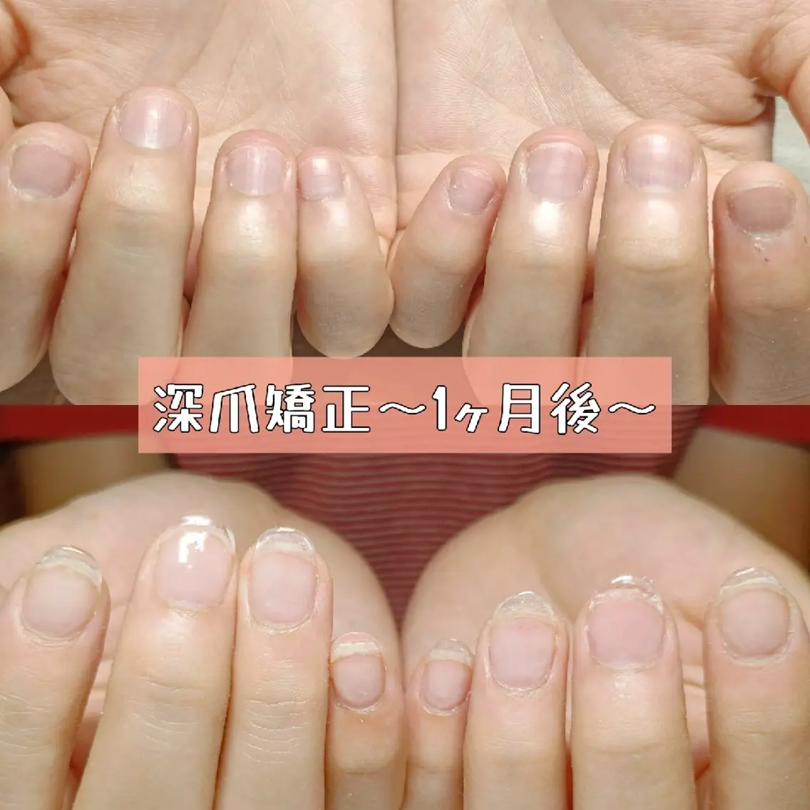 ネイル ハンドネイル ハンドケア 深爪矯正/爪育成ケア manie nailのネイルデザイン