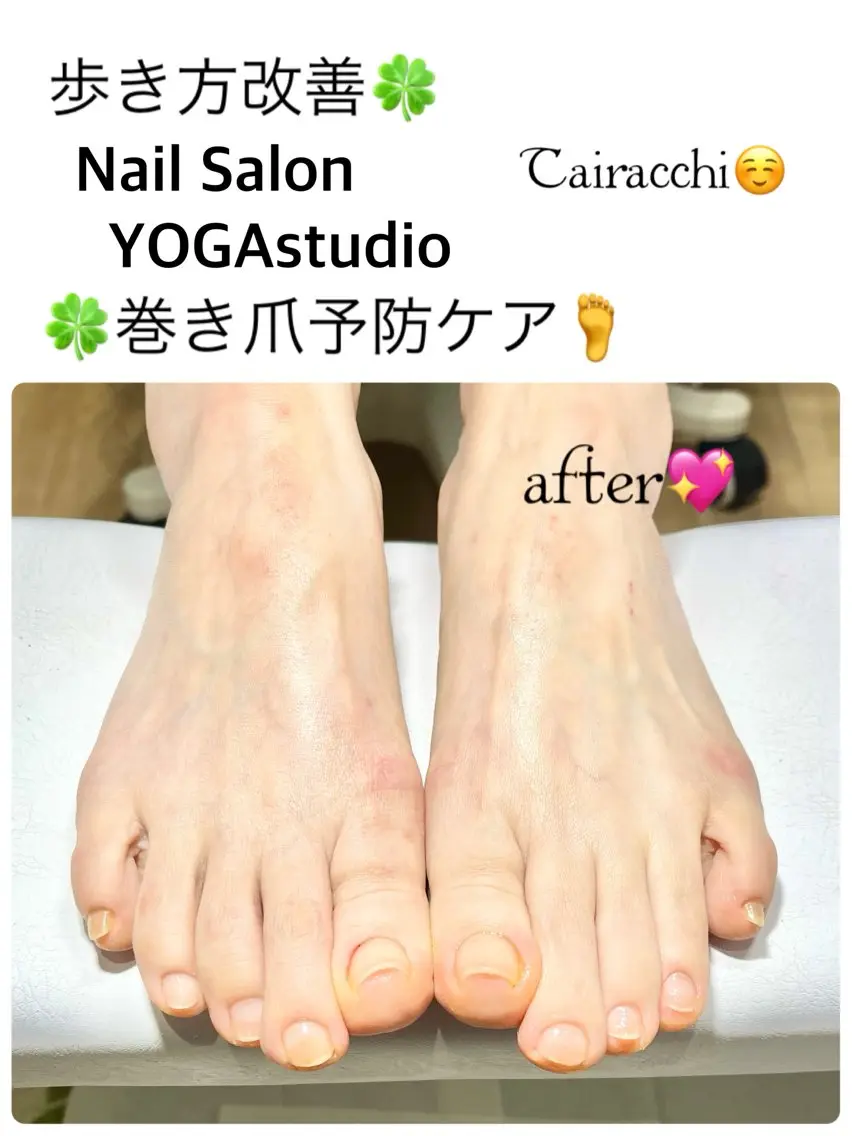 ネイル フットネイル フットネイル Tairacchi タイラッチのネイルデザイン