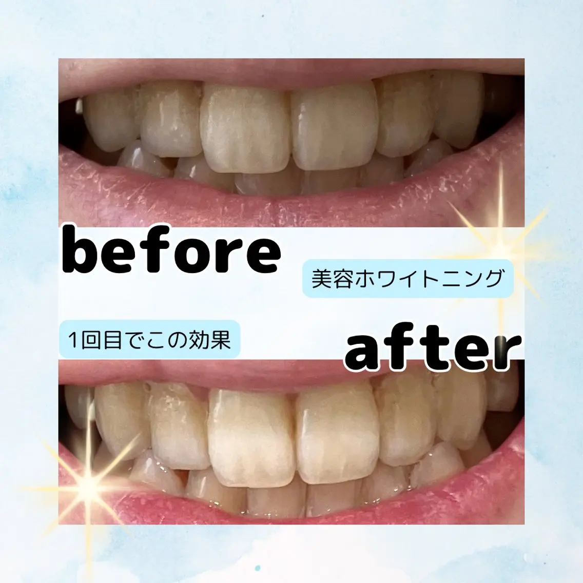 ホワイトニングサロン Soleilのその他イメージ
