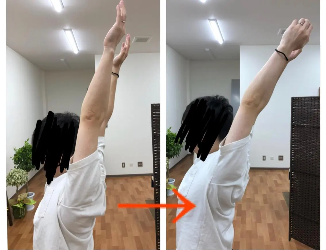 【全身調整】　　　　　　　　　　　　　　　　　　　　高周波温熱美容機＋波動型空気圧美容機＋筋骨格調整＋内臓ケアの写真