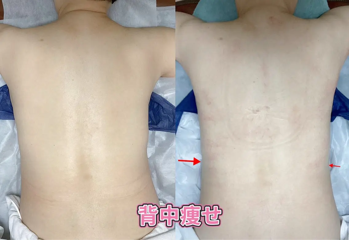 【5月応援スペシャル】身体部分集中ボディスリムケアの写真