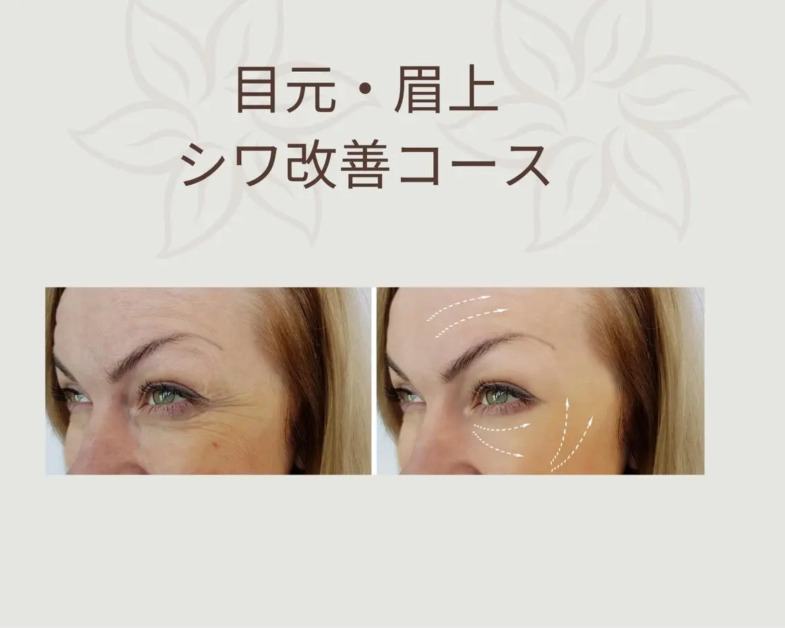 【整体フェイシャル】　目元/眉上　シワ緩和コースの写真