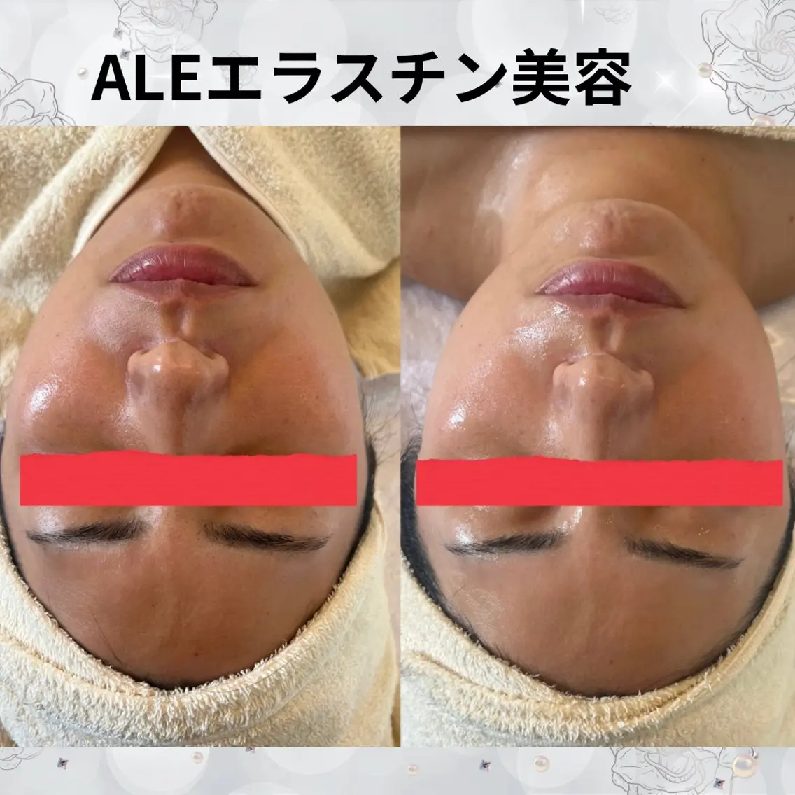 エステ beauty SalonRcoinのマツエク・マツパデザイン
