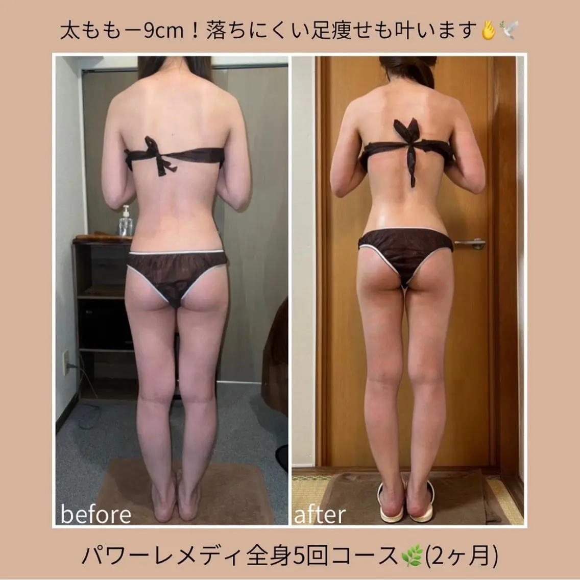 《本気痩せ×疲労改善 》  BILOOPのエステ・リラクイメージ