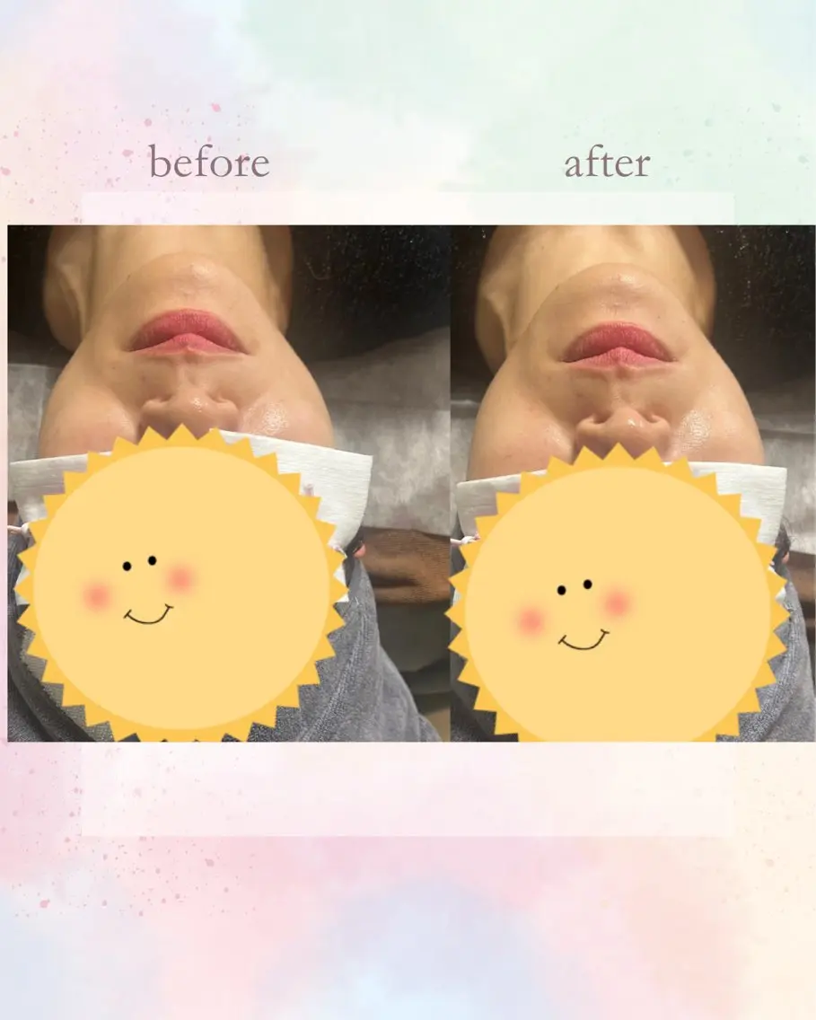 エステ Belle ＋vi（ベル）のその他イメージ