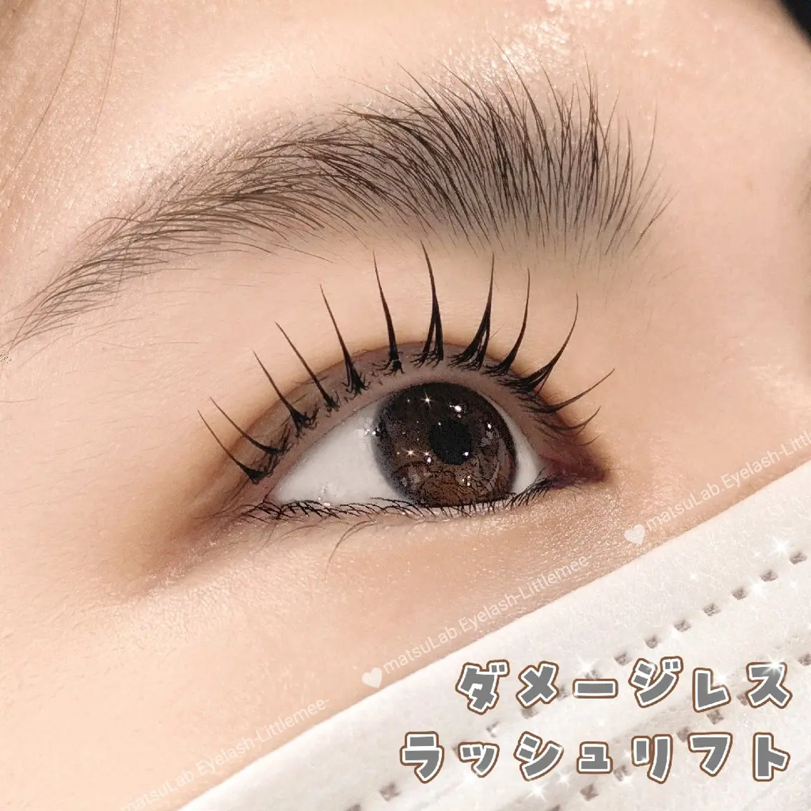 【ミニモ学割】ダメージレスラッシュリフト3,600円の写真