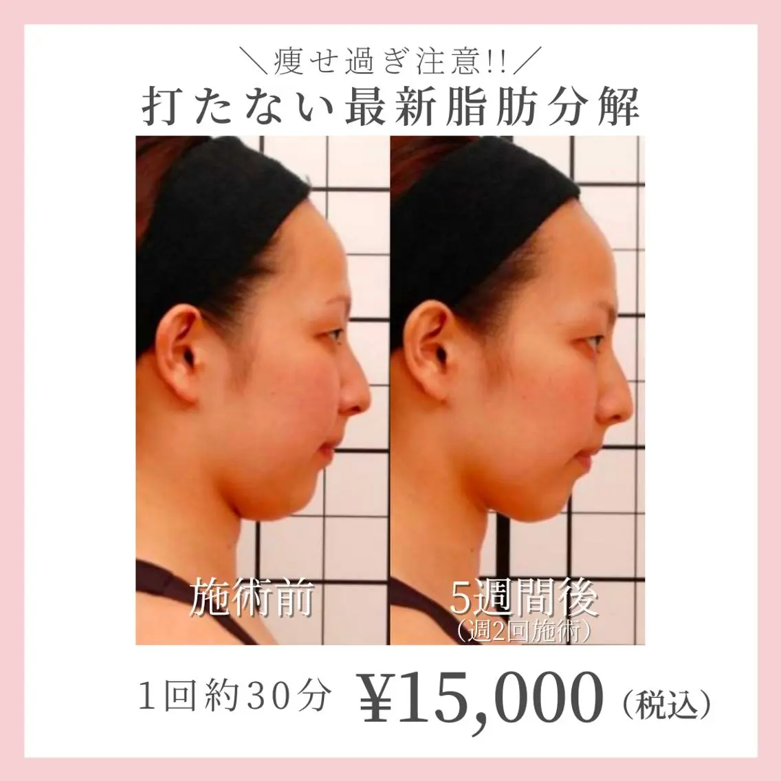 コガオファクトリー 北24条店のエステ・リラクイメージ