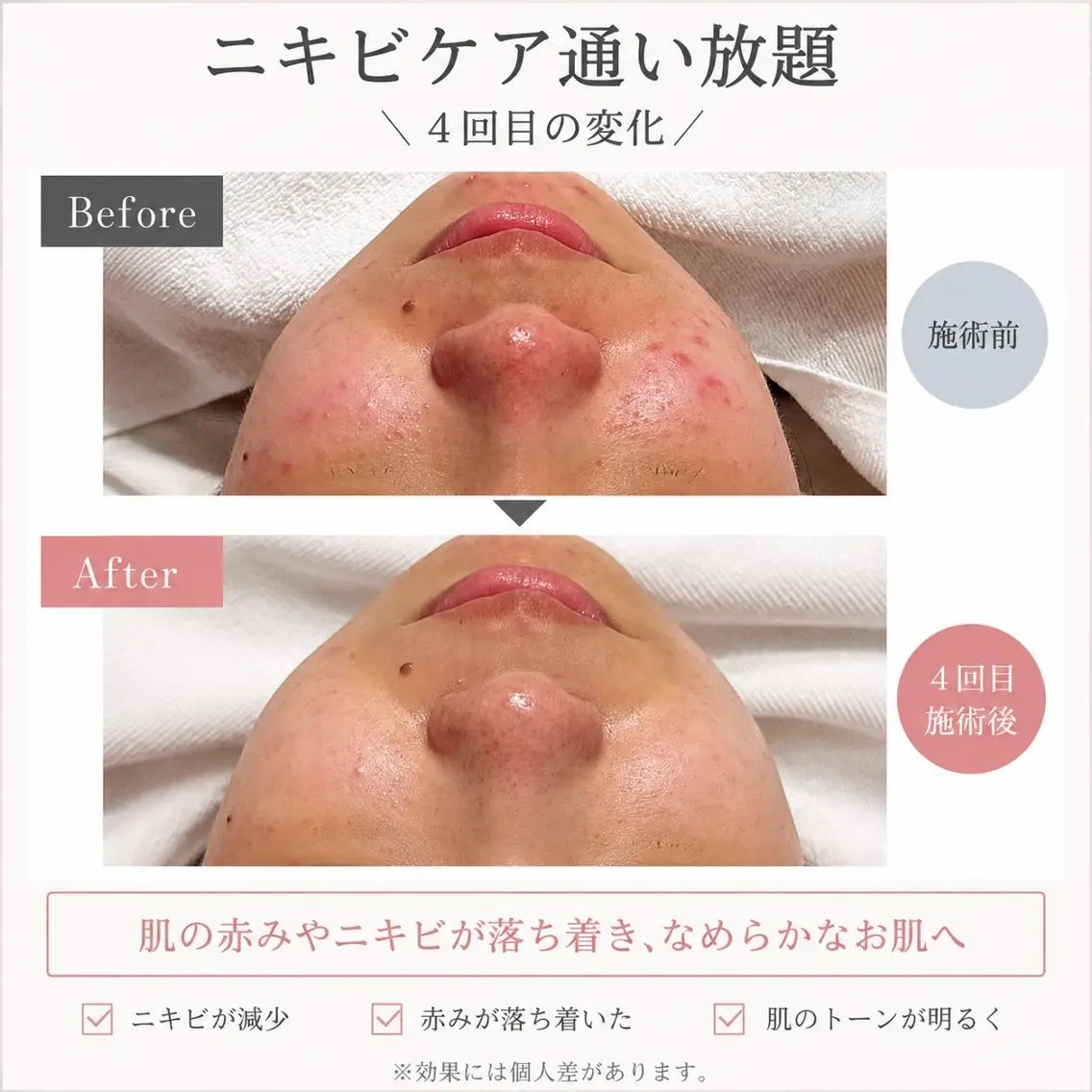 【美肌・脱毛専門店】 SARA 恵比寿店のエステ・リラクイメージ