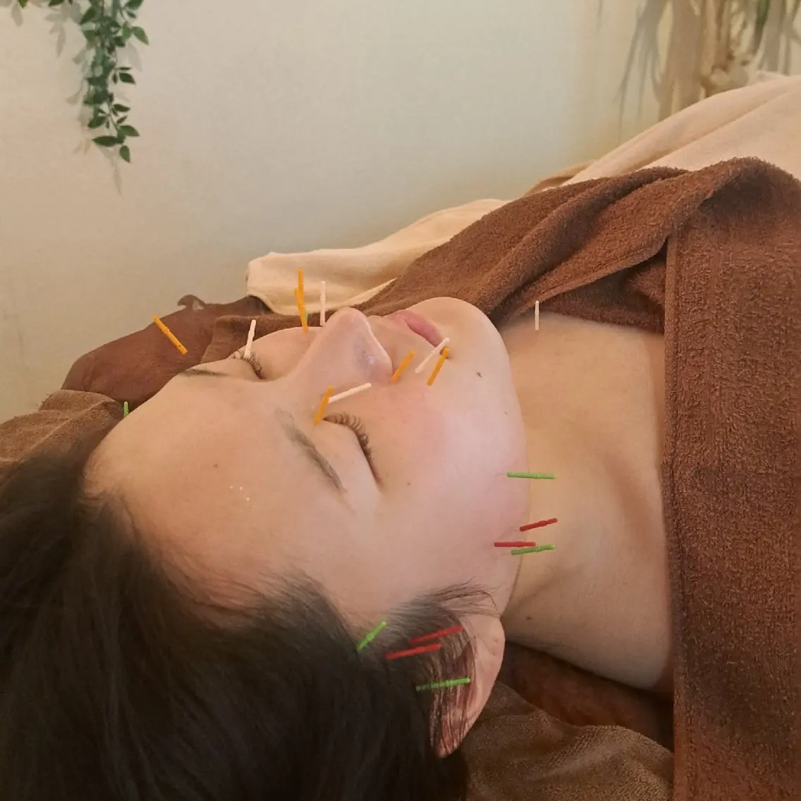 エステ リラク 美容鍼×エステ 鍼灸 サロンmiyabiのエステ・リラクイメージ