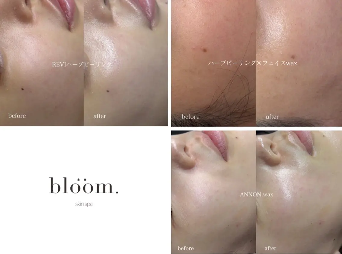 blöom. yuiのエステ・リラクイメージ