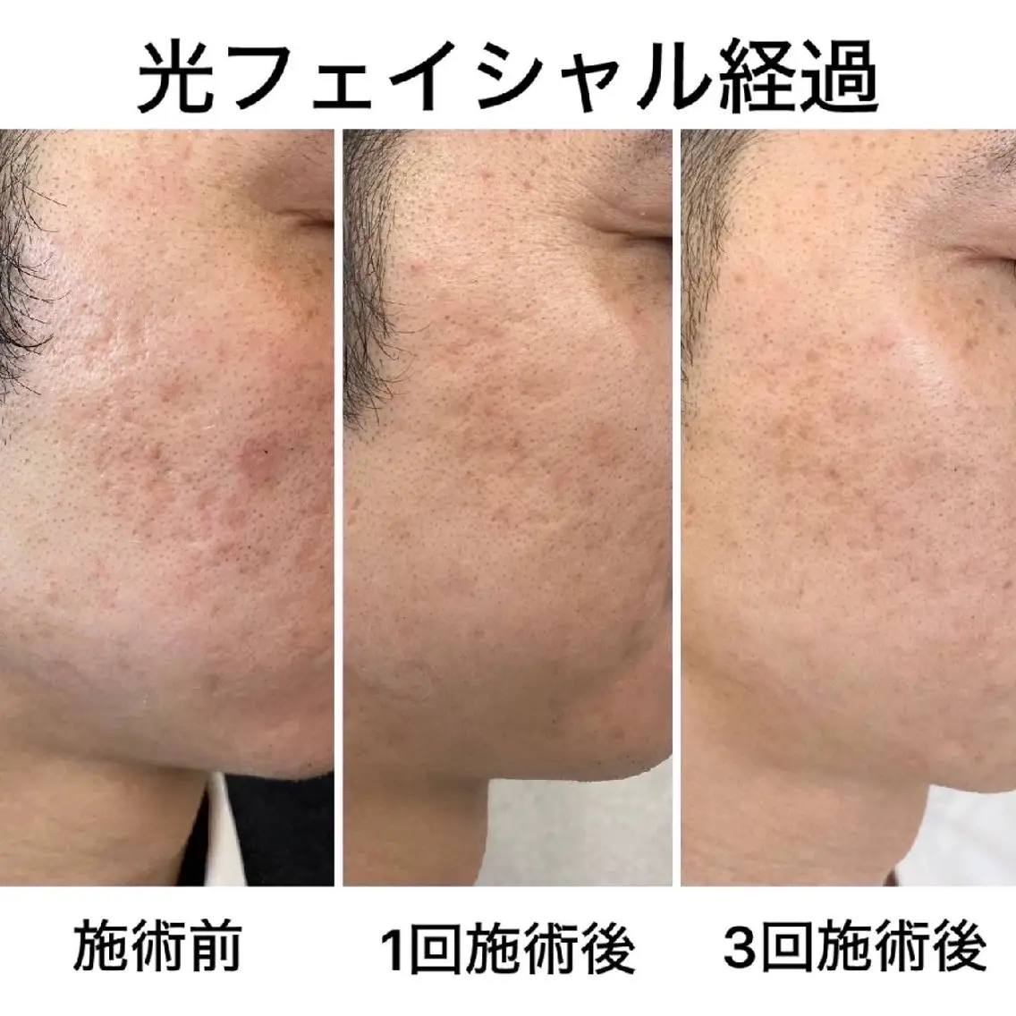 メンズ キッズ エステ 脱毛*エステ*リラク 猫の手【丸田和可子】のエステ・リラクイメージ