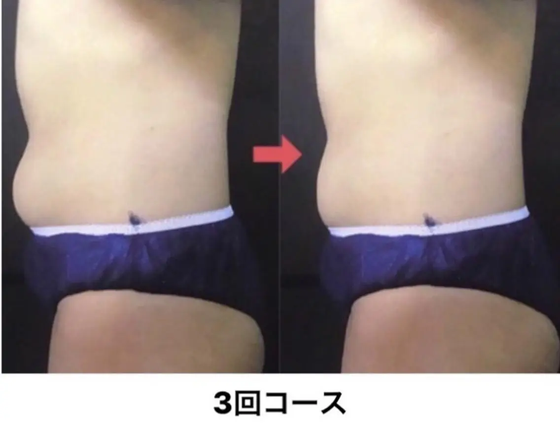 横浜エステサロン R-ing リングのエステ・リラクイメージ
