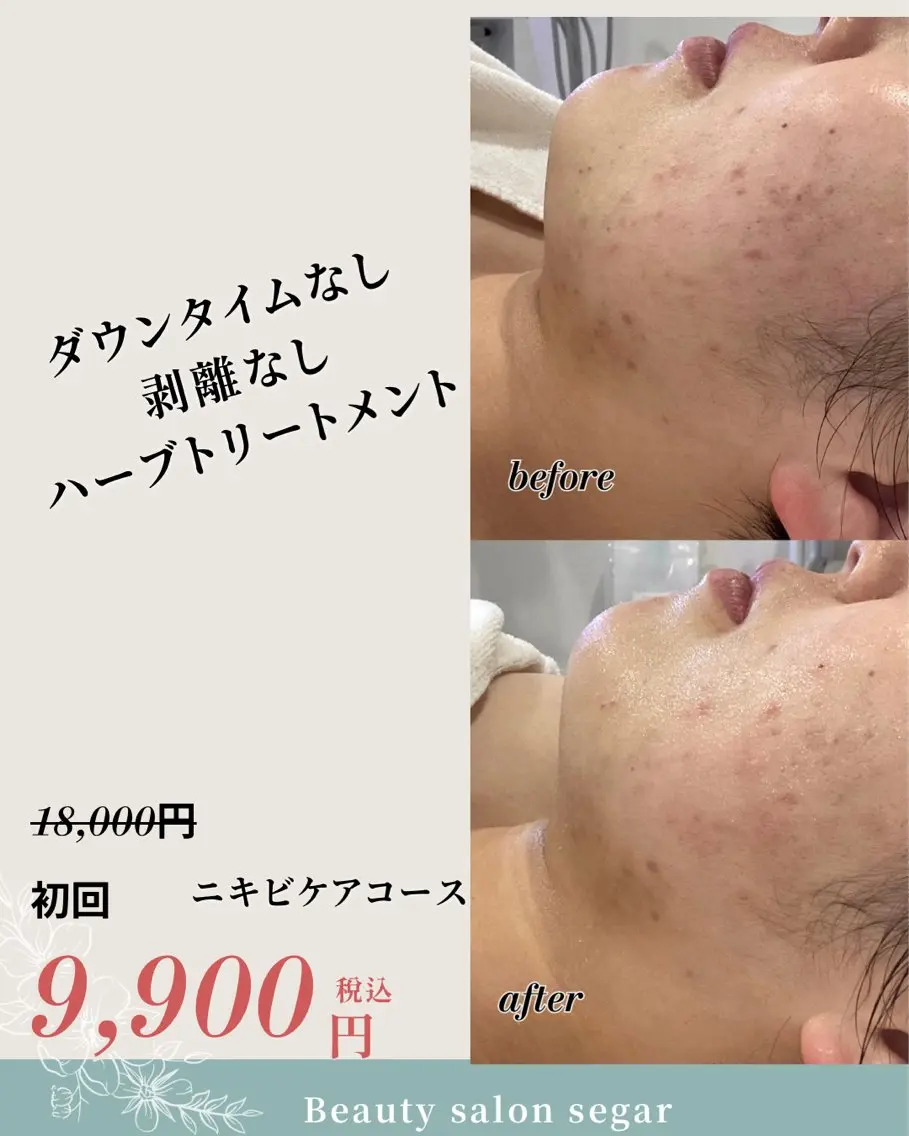 エステ segar 菅野枝里子のエステ・リラクイメージ