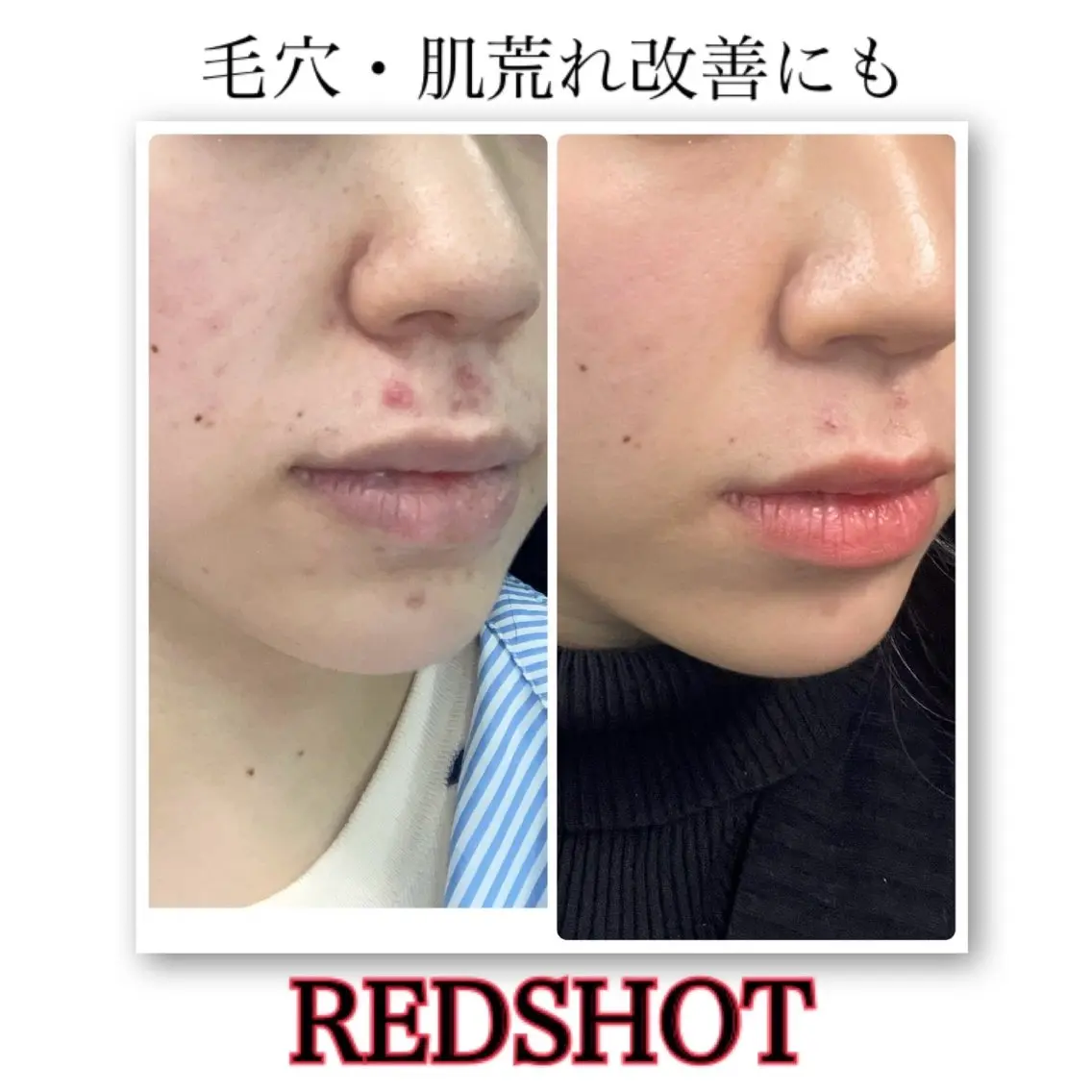 その他 肌改善・脱毛・痩身 LuanaLifeのエステ・リラクイメージ