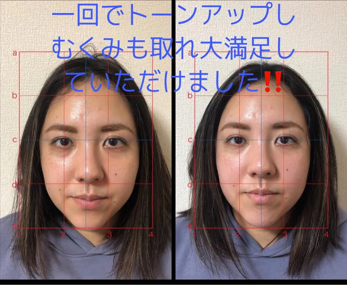 やはた 鍼灸整骨院のエステ・リラクイメージ