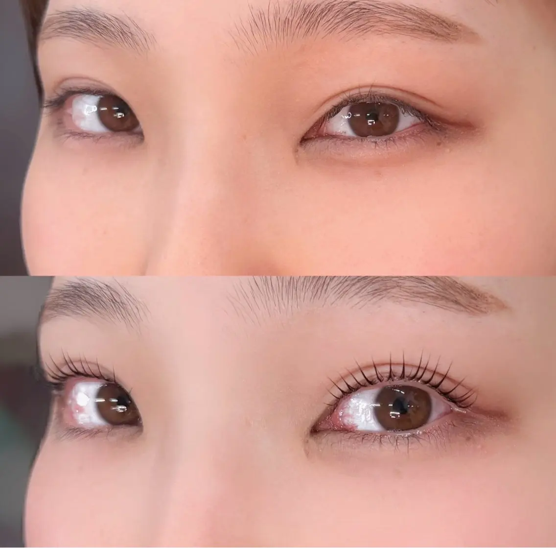 UpforceLift+NOBIRUの写真