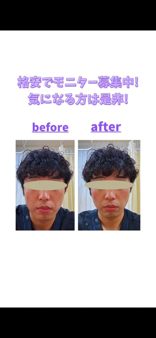 フェイシャルエステ💆¥3300→¥1100の写真
