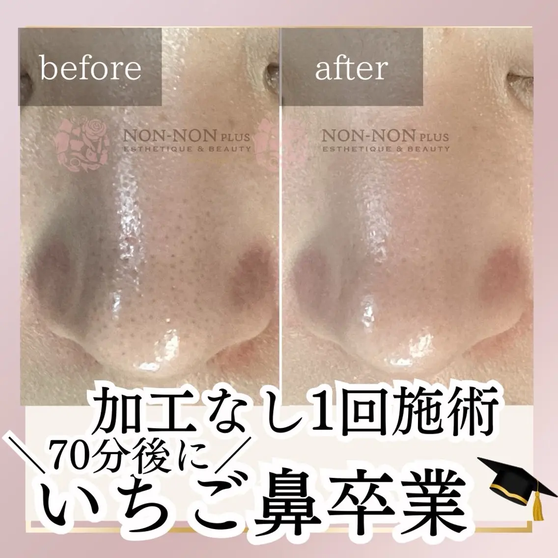 NON-NONプラス 大人の本気痩身のエステ・リラクイメージ