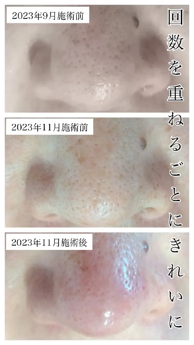 エステサロン LYSH愛名のエステ・リラクイメージ