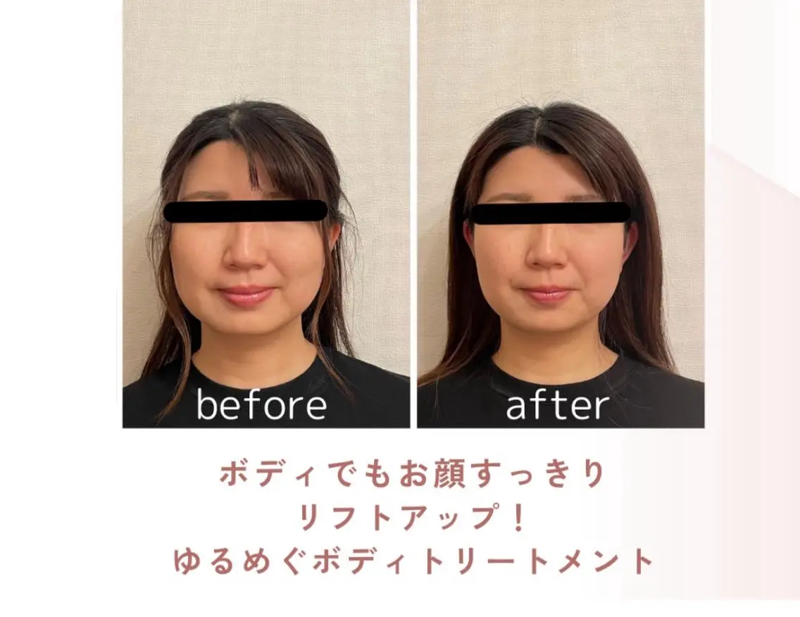 町田・鶴川 小顔矯正 /鈴木友実のエステ・リラクイメージ