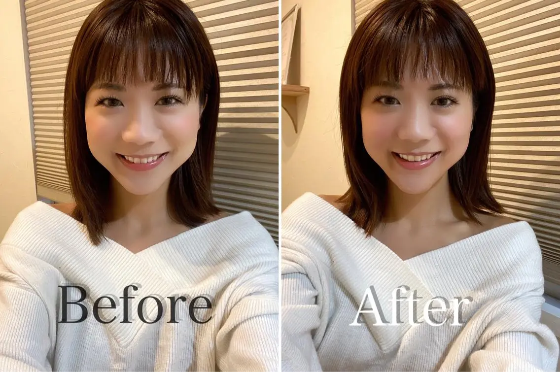 鍼灸 Refineのその他イメージ