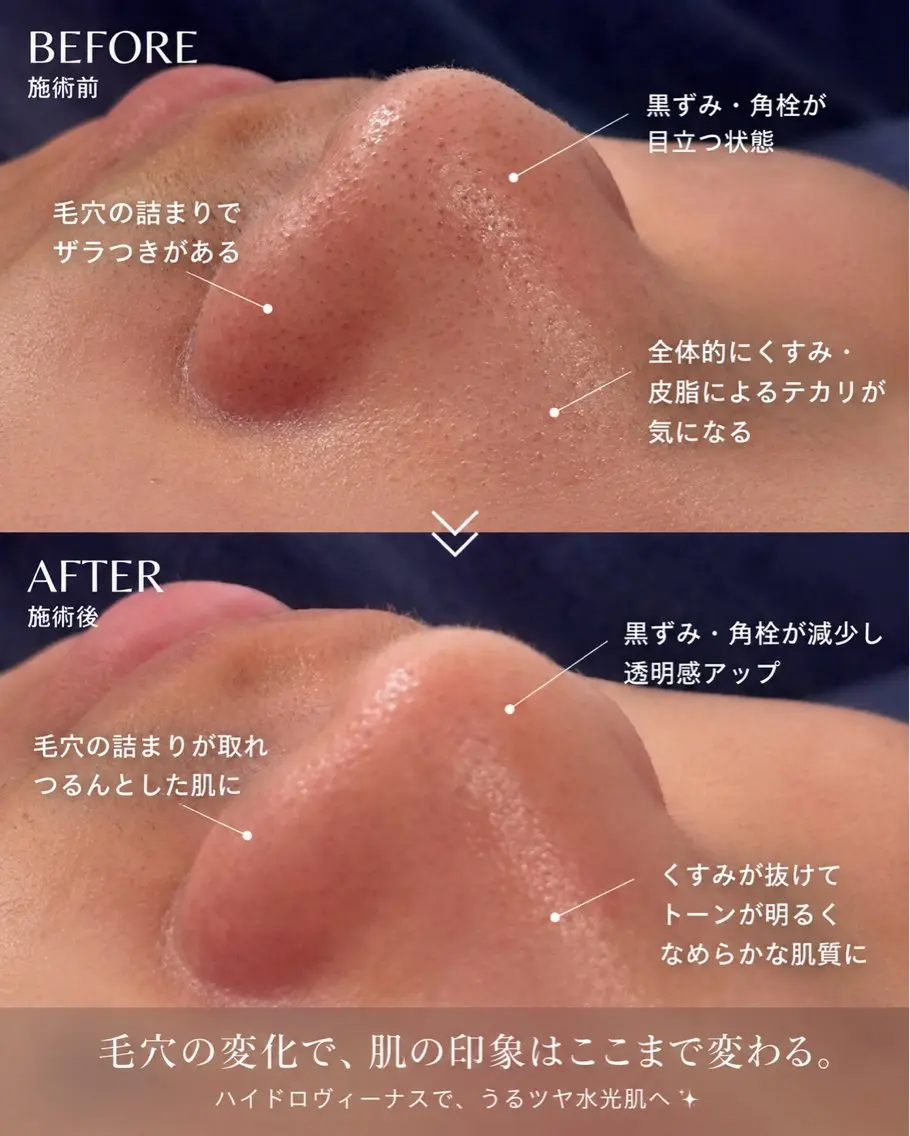 エステ 肌管理専門｜ Freviaのエステ・リラクイメージ