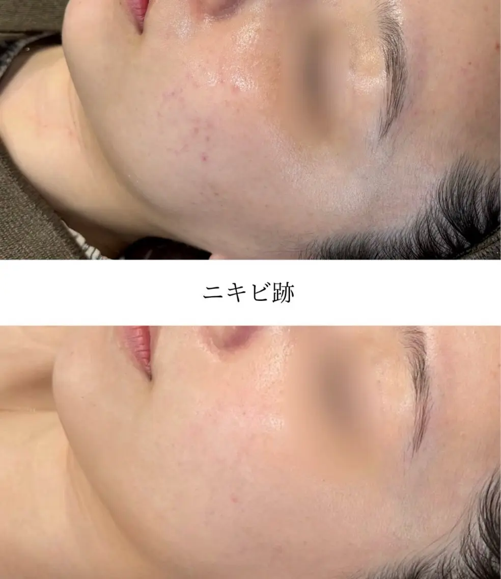 エステ 💎Queen Beauty🫧のエステ・リラクイメージ