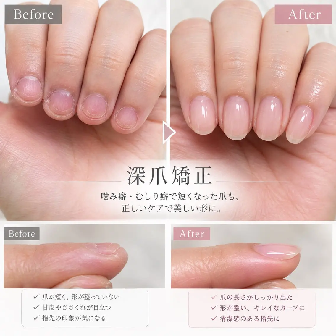 ネイル ハンドネイル ELAN Akaneのネイルデザイン