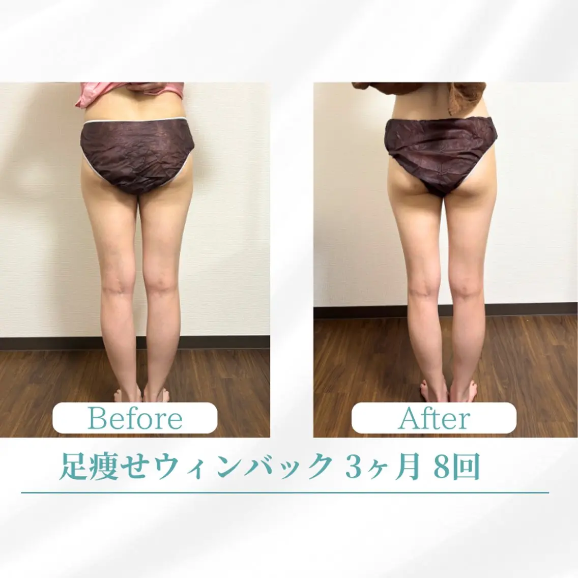 エステ リラク 美容鍼サロン ボディコンディションのエステ・リラクイメージ
