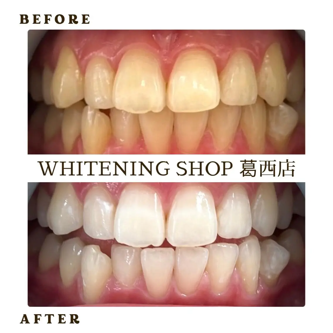 メンズ その他 ホワイトニング ショップ葛西店のその他イメージ