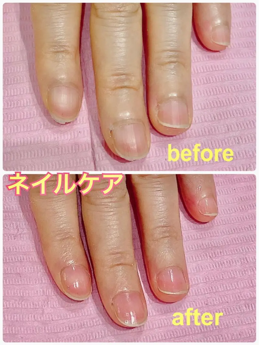 初回✨ネイルケアの写真