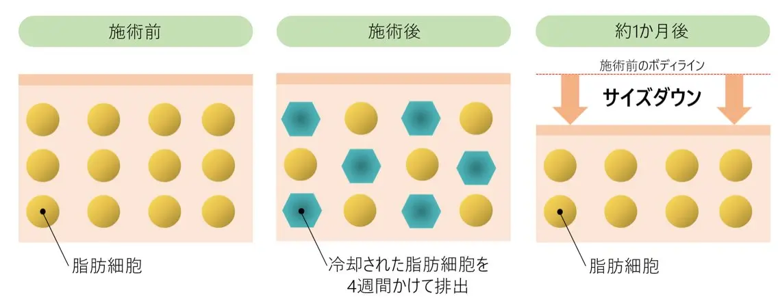 解剖生理学に基づいた 個室リンパ痩身のエステ・リラクイメージ