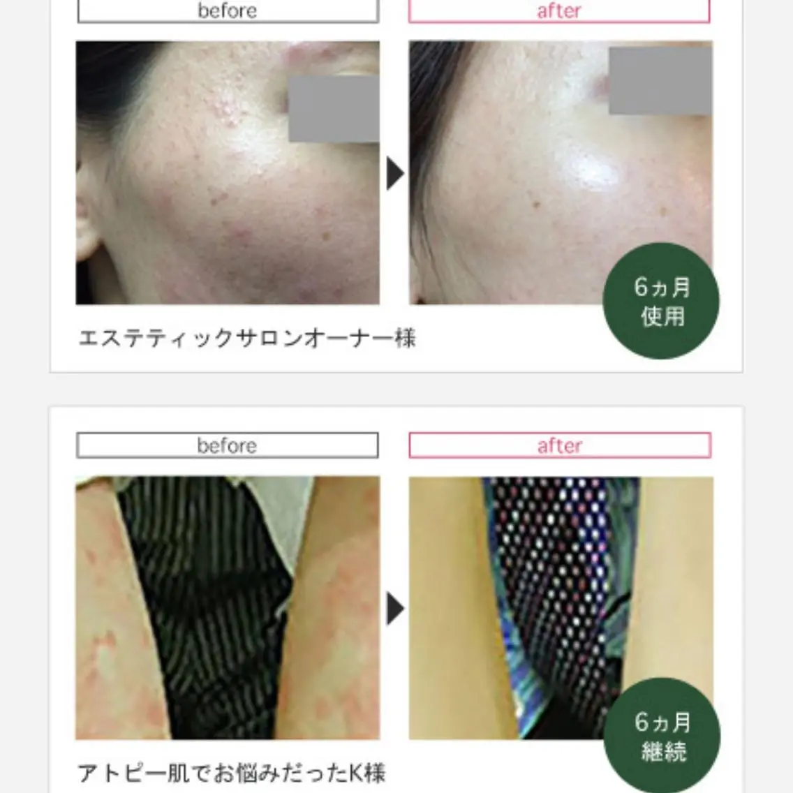 美肌育成サロン LEA武蔵小杉のエステ・リラクイメージ