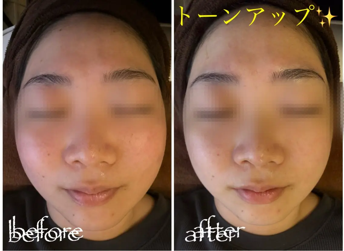 脱毛 フェイシャル soin~ソワン~のエステ・リラクイメージ