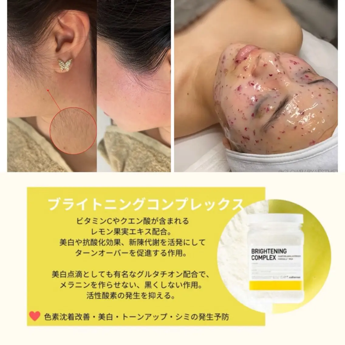 ワックス脱毛/光脱毛 🎀新宿駅徒歩5分のエステ・リラクイメージ