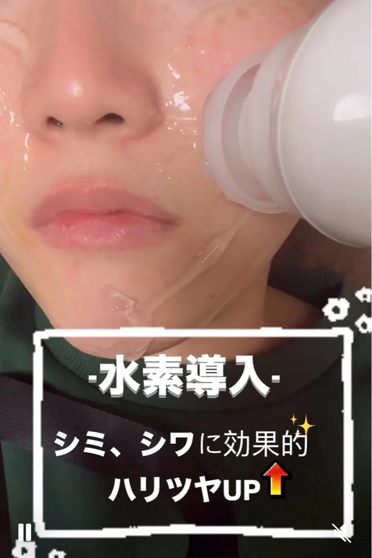 水素導入(シミ、シワ、透明感、保湿)の写真