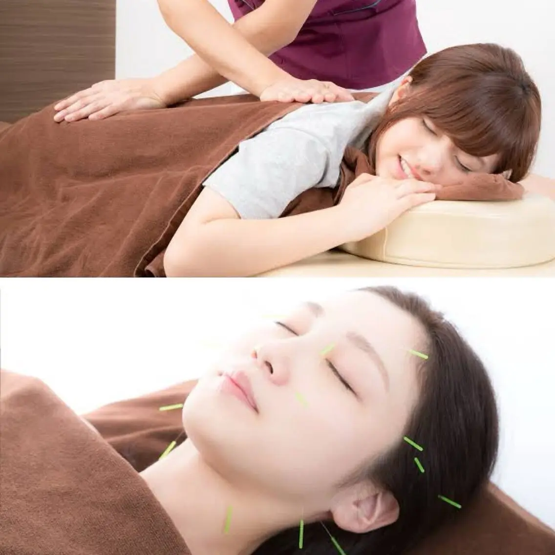 【女性人気No. 1】整体✖️美容鍼 身体とお顔どちらも整う ¥10400→3500の写真