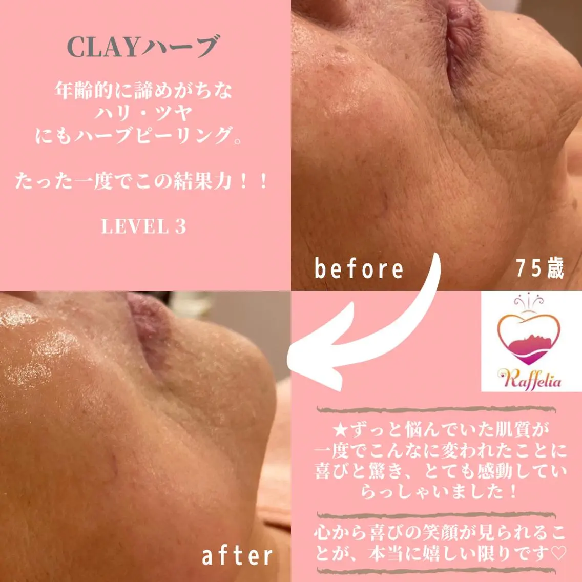 🌈Raffelia ラフェリア✨のエステ・リラクイメージ