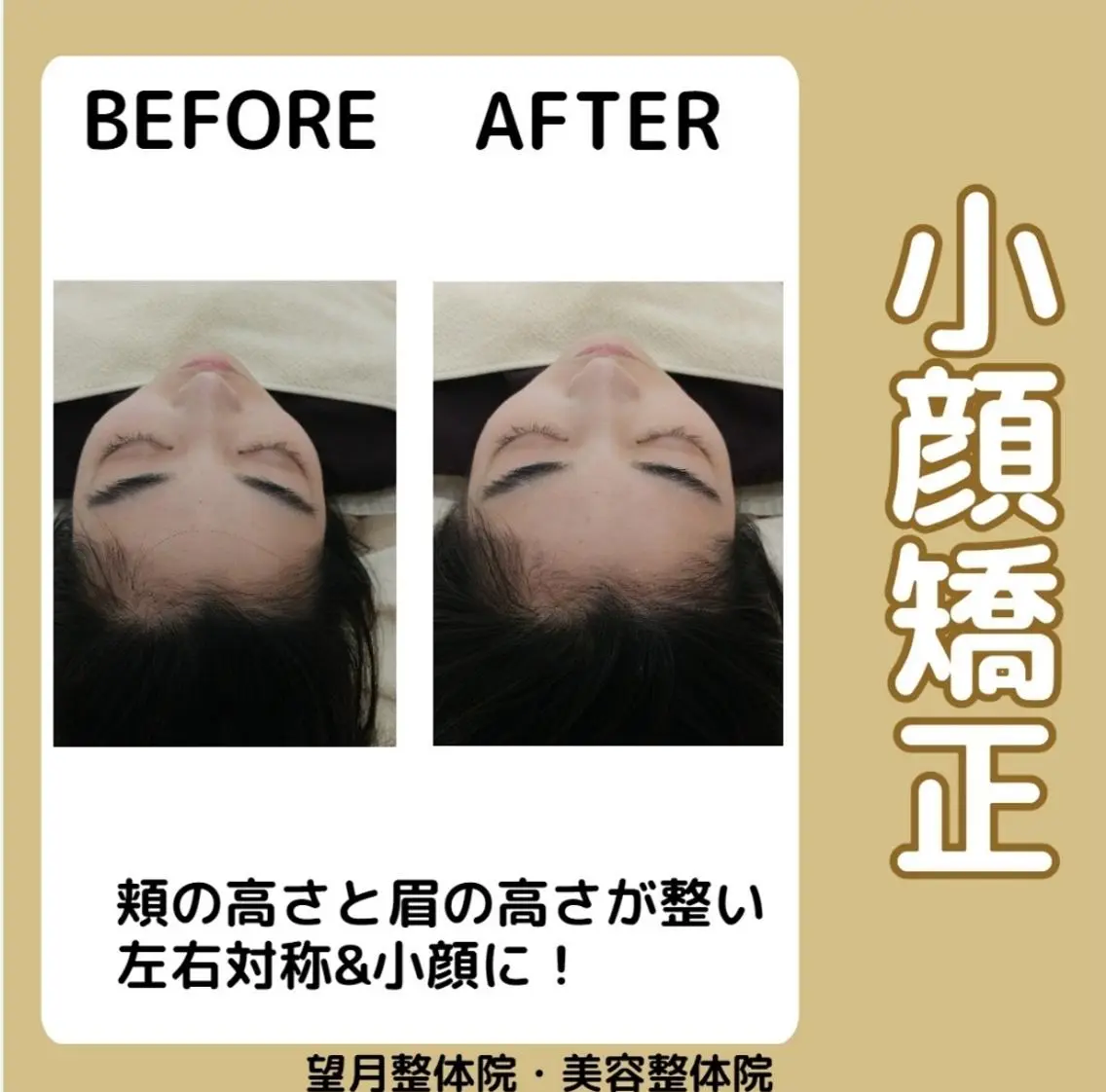 【小顔矯正❇️背骨矯正付き】むくみ・歪みスッキリ🎶頭のサイズも小さくします💪背中、肩、首のマッサージ付き‼️の写真