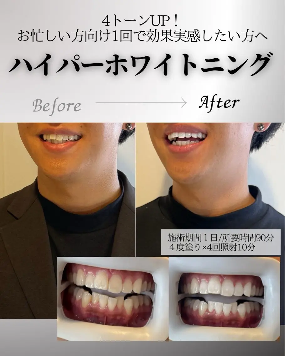 歯科提携エラン ホワイトニング一社店のその他イメージ