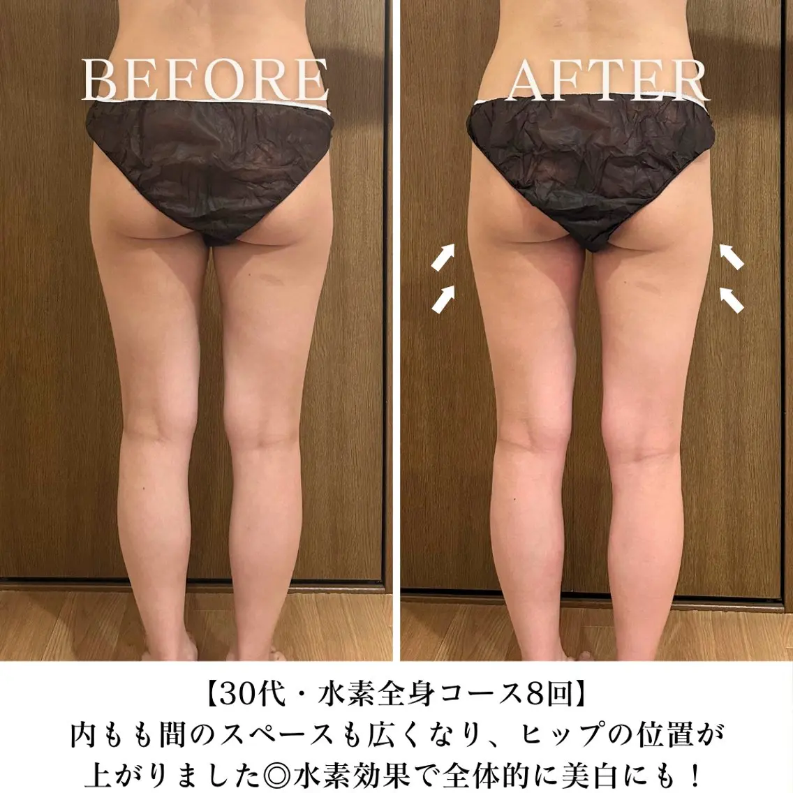 【目黒】本格痩身✴︎ 最新型よもぎ蒸しのエステ・リラクイメージ