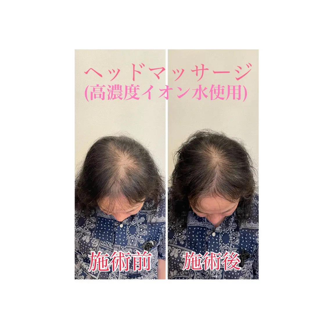 町田・鶴川 小顔矯正 /鈴木友実のエステ・リラクイメージ