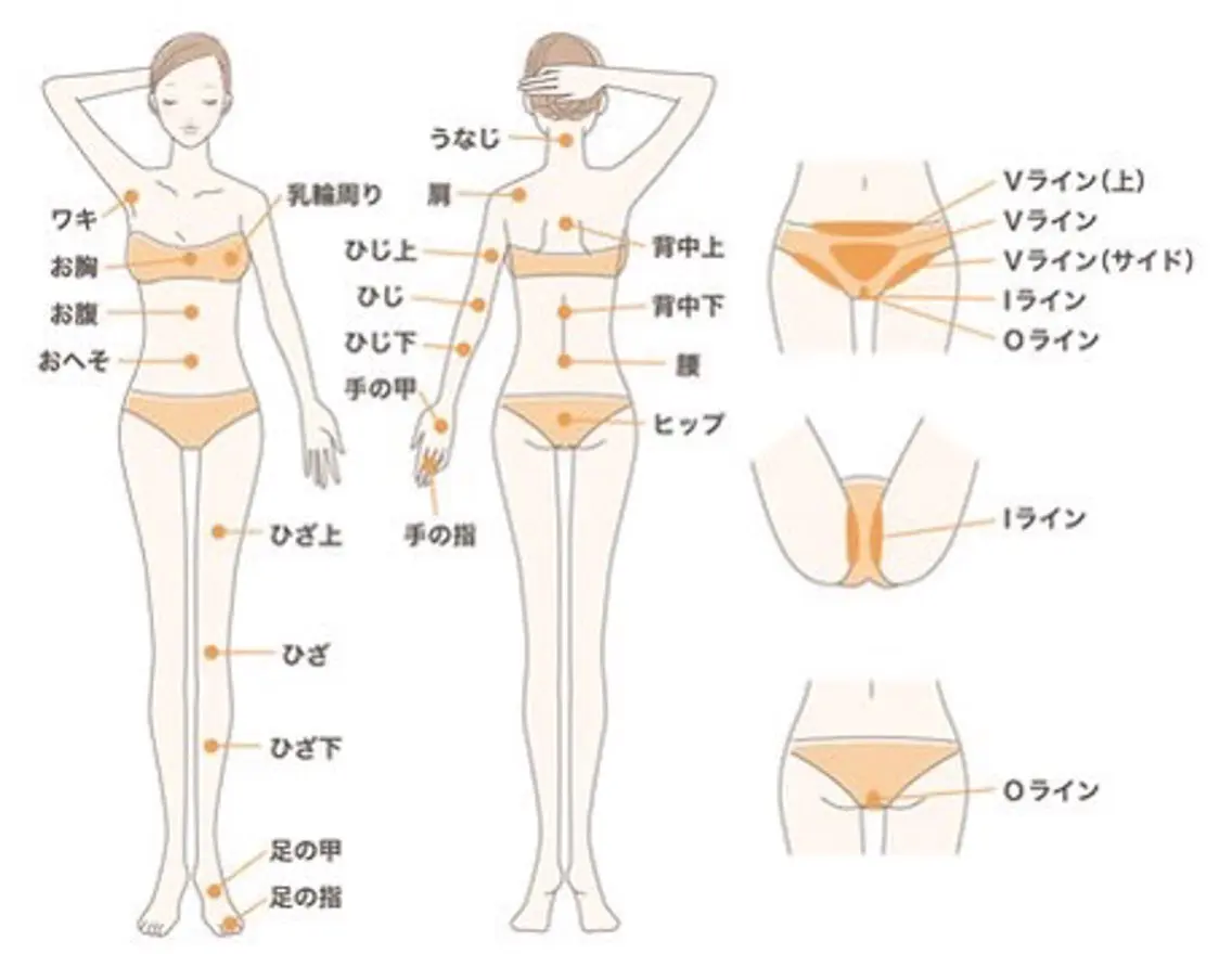 【迷われた方】脱毛部位のご相談¥0の写真